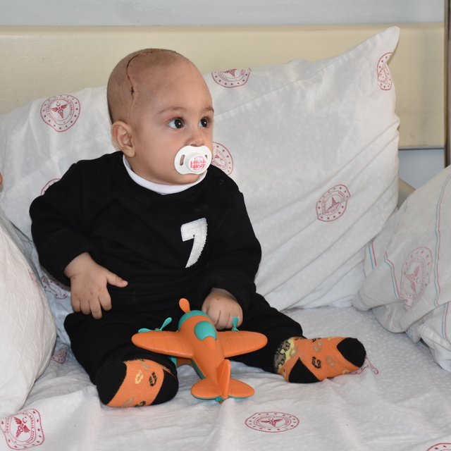 Van'da 7 aylık bebeğin kafatasındaki şekil bozukluğu 5 saatlik ameliyatla g...