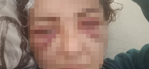 Elektronik kelepçeyi kırıp kendisini yaralayan ve kaçan eşinin yakalanmasın...