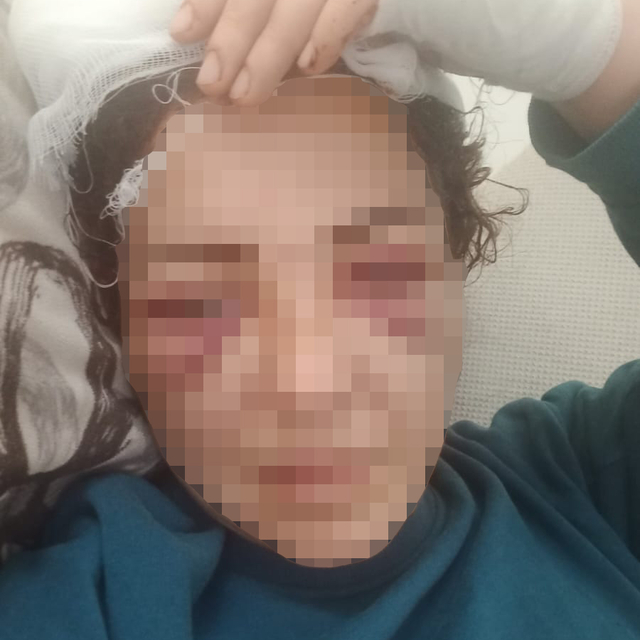 Elektronik kelepçeyi kırıp kendisini yaralayan ve kaçan eşinin yakalanmasın...