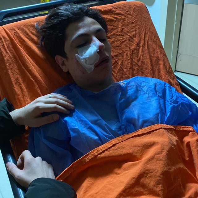 Tabancayla oynarken arkadaşını başından vurdu; 1 yaralı, 4 gözaltı (2)