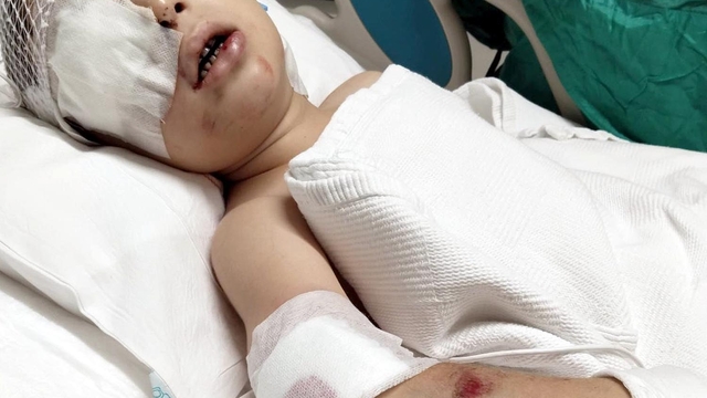 İndiği servis minibüsünün altında kalan 6 yaşındaki Emre yaşam savaşı veriyor