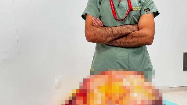 'Karın ağrısı' şikayetiyle gittiği hastanede karnından 26 kiloluk tümör çıktı