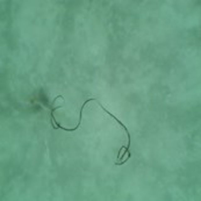 Karadeniz'de mikroplastik tehlikesinde 'nehir' etkisi