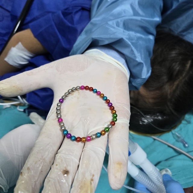 5 yaşındaki kız çocuğunun bağırsağından 38 adet mıknatıslı boncuk çıkarıldı