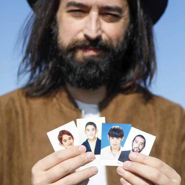 Yüzündeki tümör yalnızlığa itti, kendini müziğe adayıp müzisyen oldu