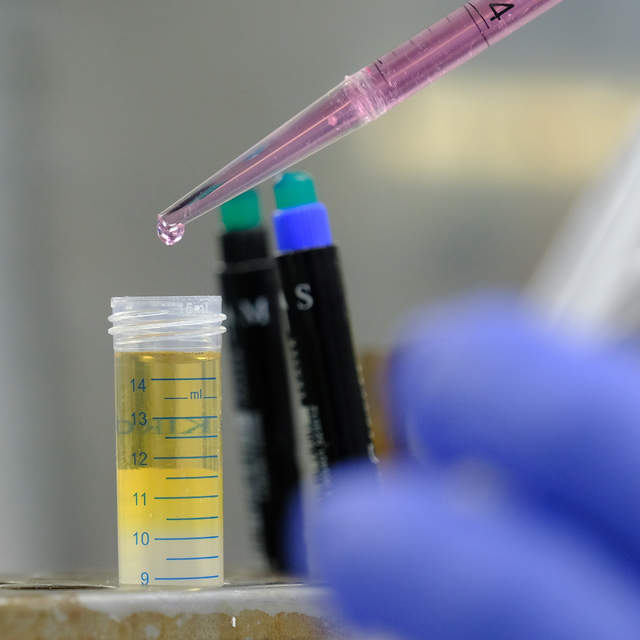 Antibiyotiklere dirençli bakterilere karşı aşı çalışması