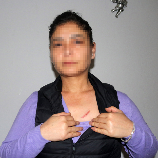 Daha önce evinin kapısını yaktığı kadını, elektrikli düzenekle öldürmeye ça...