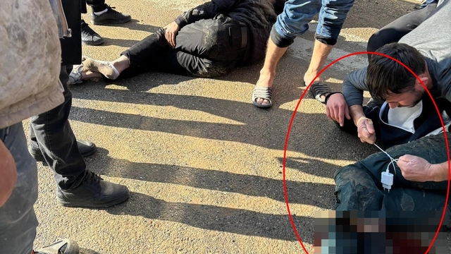 Yaralıya şarj kablosu ile turnike; kaza kamerada