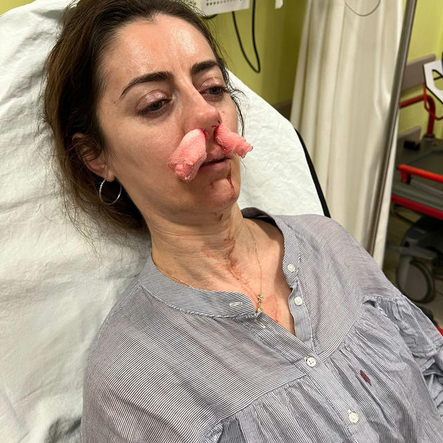 Kendisini eşinin sevgilisi zanneden kadın tarafından darbedildi