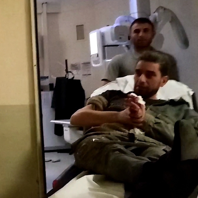 Sunta keserken elini makineye kaptıran işçinin parmağı koptu