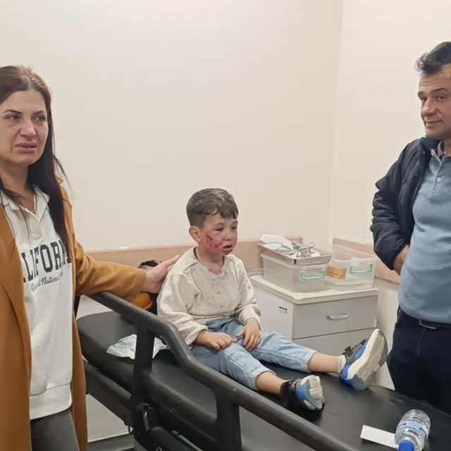 Hatay'da sahipsiz köpeğin saldırısına uğrayan çocuk yaralandı