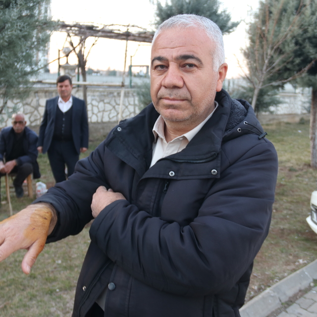 Diyarbakır'da sahipsiz köpeğin saldırısına uğrayan 3 kişi yaralandı