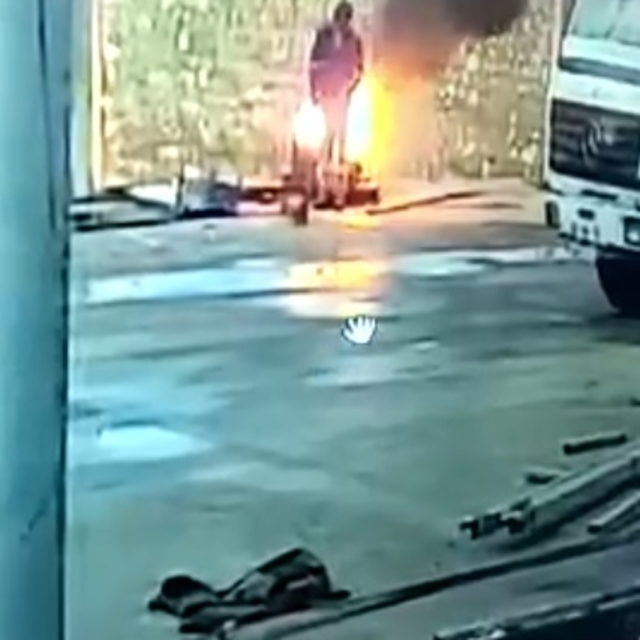 Varildeki ateşte ısınmaya çalışırken pantolonu tutuştu: O anlar kamerada