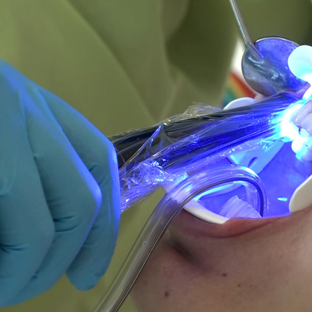 'Beyazlatma işleminde yanlış uygulama diş kaybına neden olabilir'