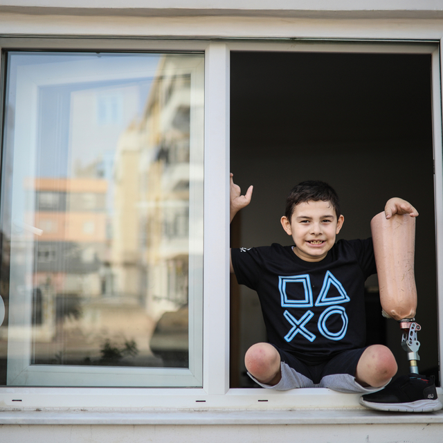 Bacakları kesilen Aras'ın protez borcuna icra işlemi