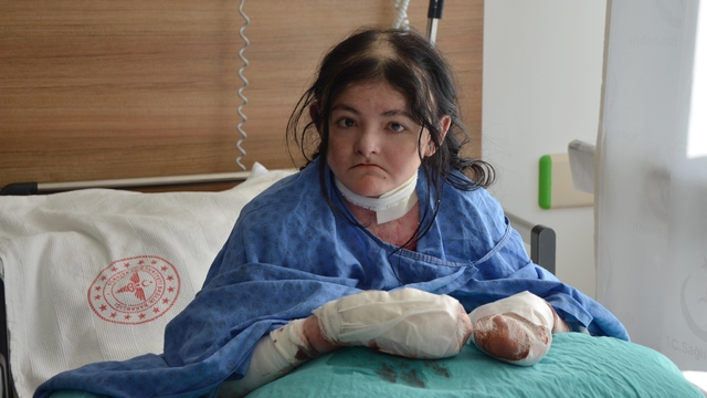 Amerikalı Arias'ın 20 yıldır kullanamadığı parmakları Eskişehir'deki operasyonla açıldı