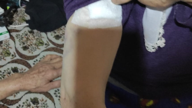 Burdur'da sahipsiz köpeklerin saldırdığı kadın yaralandı