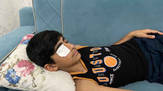 Yapıştırıcı sıçrayınca kapanan göz kapağı doktor müdahalesiyle açıldı