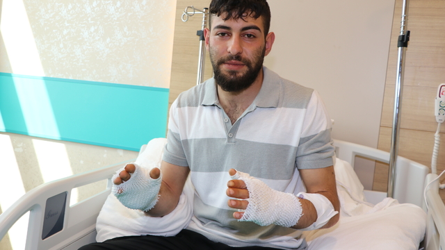 Erzurum'da hararet yapan otomobiline aceleyle müdahale edince elleri yanan teknisyen hastanelik oldu