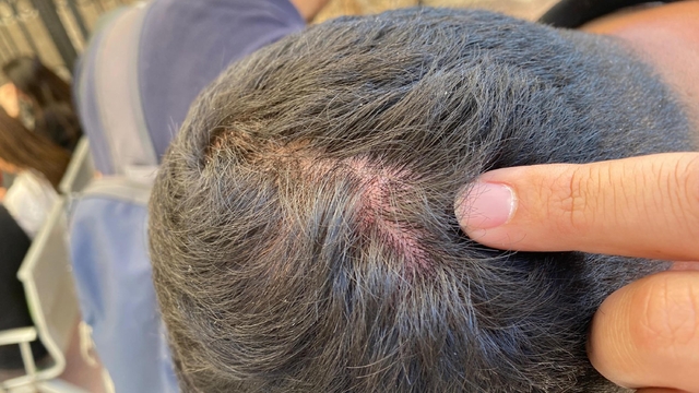 İzmir'de sahne kurulumu sırasında vinç devrildi; çalışanlar gazetecileri darbetti