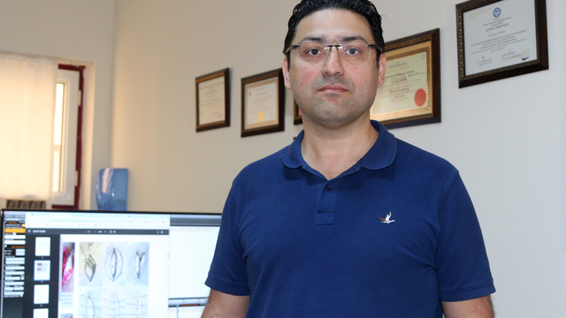 Kıl dönmesine estetik ve kalıcı müdahale