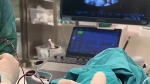 Anne karnındaki 8 aylık bebeğe kan nakli yapıldı