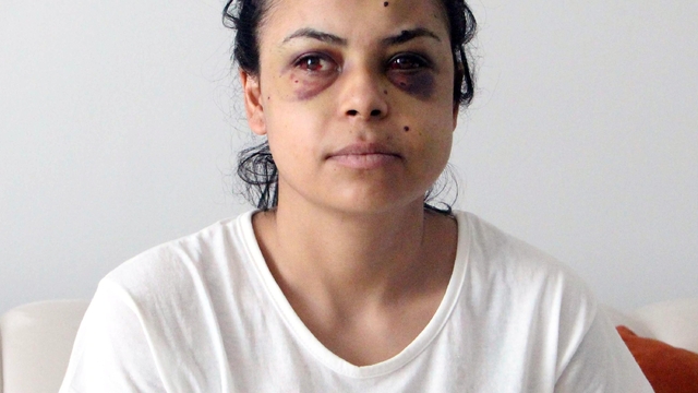 Düğünde tüfekle ateş açıldı, penceredeki Nazar gözlerinden yaralandı