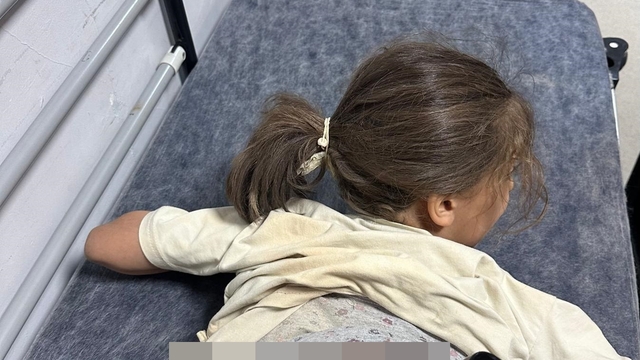 Sokak köpeklerinin saldırısına uğrayan Zeynep, yaralandı