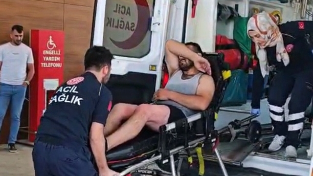 Tamir ettiği otomobilin radyatöründen sıçrayan kaynar suyla yaralandı