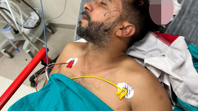 Adana'da döner ustası, iş yerinde başına isabet eden yorgun mermiyle yaralandı