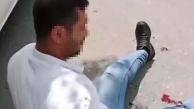 Kendisini rahatsız eden kişiyi bacağından yaralayıp sosyal medyada paylaştı; tutuklandı