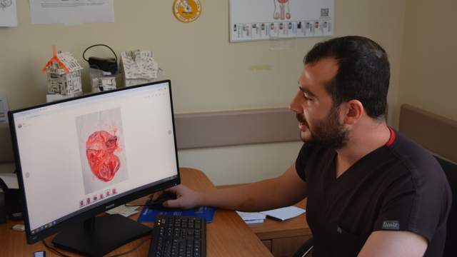 Karın şişliği için hastaneye gitti, böbreğinden 23 santimetrelik kist çıkarıldı