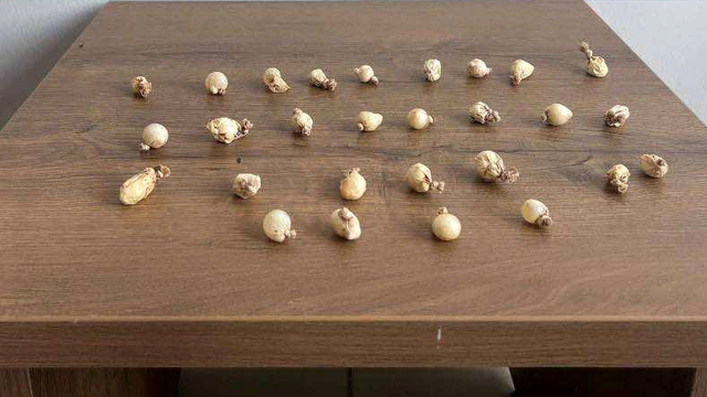 Kocaeli'de jandarmanın şüphelendiği kişinin midesinden uyuşturucu çıktı