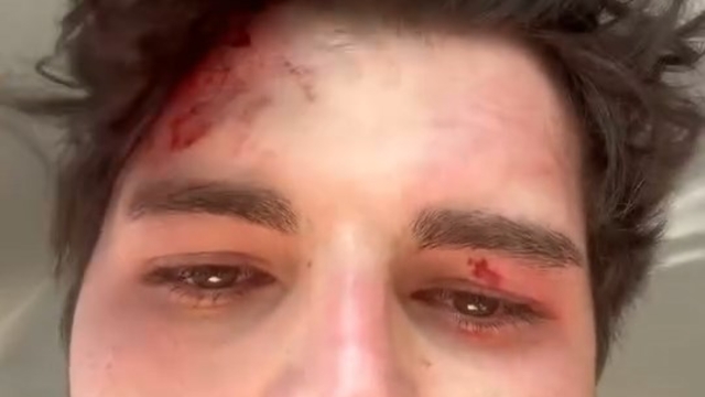 4 kişinin trafikte darbettiği oyuncu: Öldürene kadar döveceklerdi