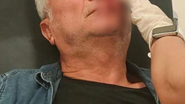 Adana'da muhtarı darbeden 3 kişi tutuklandı