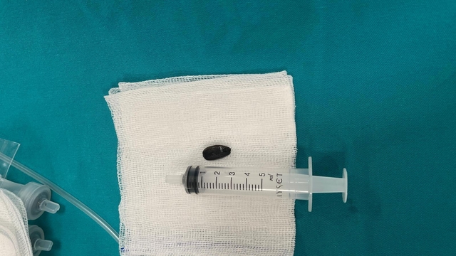 Batman'da akciğerinden çekirdek kabuğu çıkarılan 15 aylık bebek sağlığına kavuştu