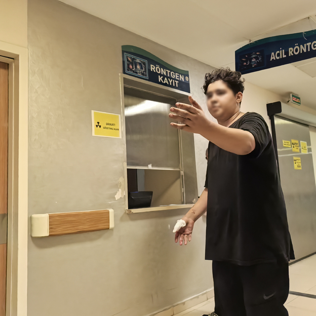 Motosikletin zincirine elini kaptıran Muhammed'in parmağı koptu