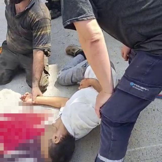 Tamircileri izlerken takozun kayması sonucu başı damper kapağına sıkışan şo...