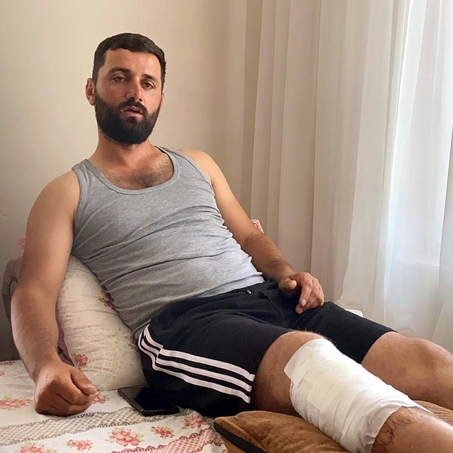 Arkadaşının kürekli müdahalesiyle kendisine saldıran ayıdan kurtuldu