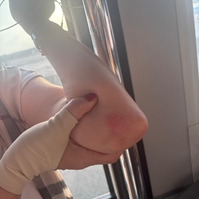 Antalya Havalimanında iniş takımından duman çıkan uçağın yolcuları slayt aç...