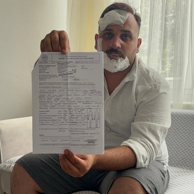 Taksici, eski sözlüsü ve ikizinin polis sevgililerinin kendisini dövdüğünü...