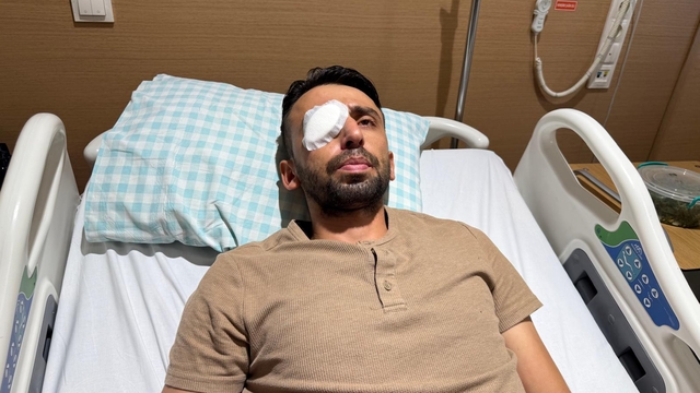 Kendisini uyaran bekçilere ateş etti, temizlik görevlisi görme yetisini kaybetti (2)