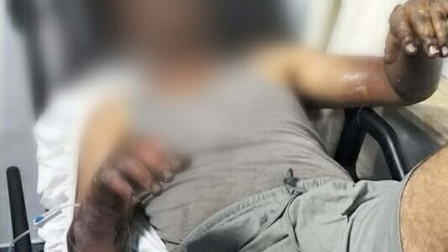 Oto tamirhanesinde patlama; 2 işçi yaralandı