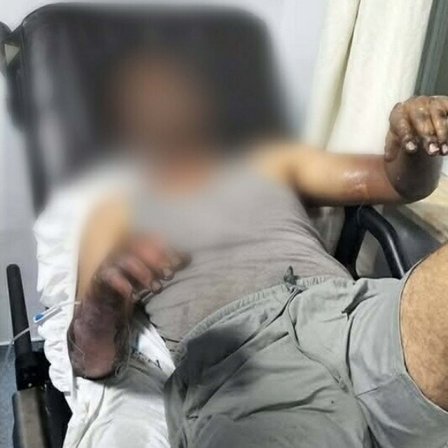 Oto tamirhanesinde patlama; 2 işçi yaralandı