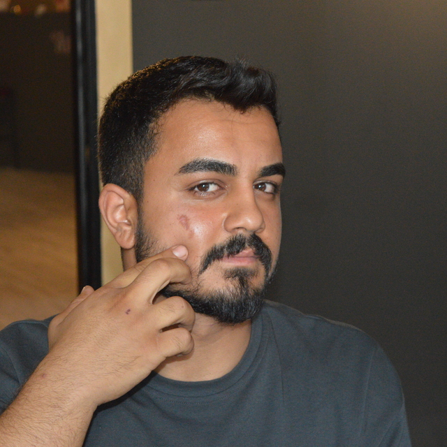 Lazer epilasyonda yüzü yandı, işletme hakkında şikayetçi oldu