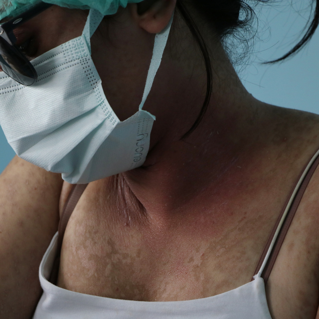 İnternetten sipariş verdiği krem hastanelik etti