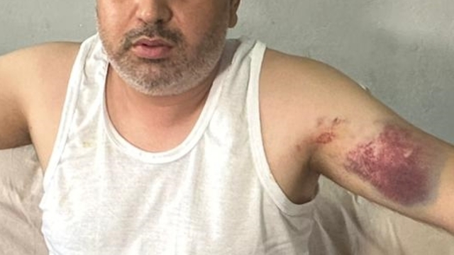 Adana'da dayısı tarafından beyzbol sopasıyla darbedilen kişi yaralandı