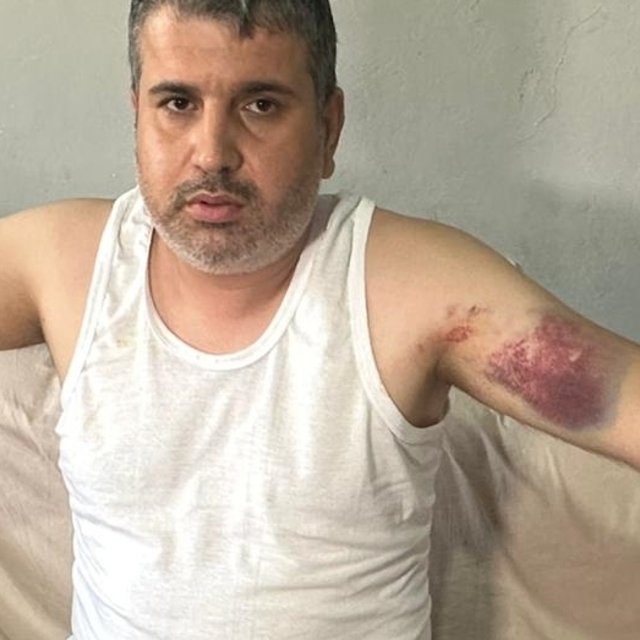 Adana'da dayısı tarafından beyzbol sopasıyla darbedilen kişi yaralandı