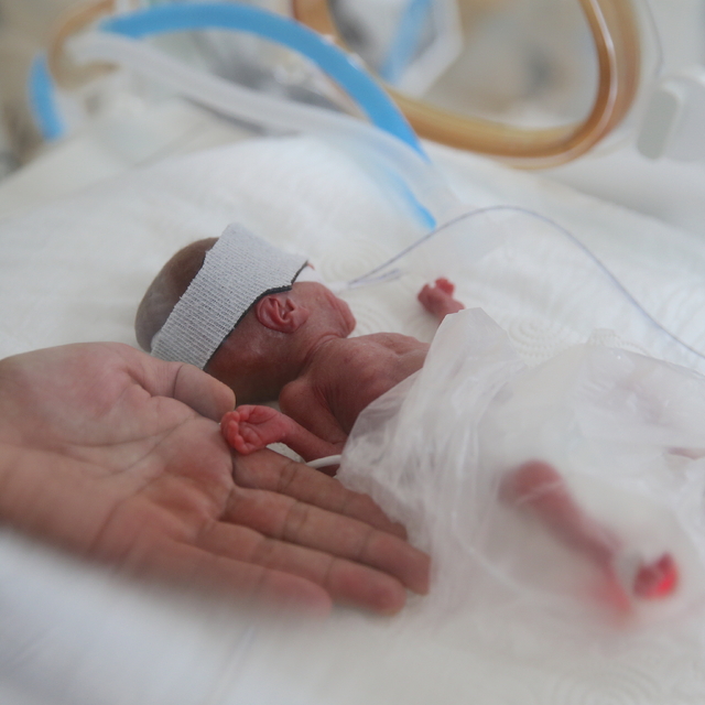 Prematüre bebekler, sağlık çalışanlarının çabasıyla hayata tutunuyor