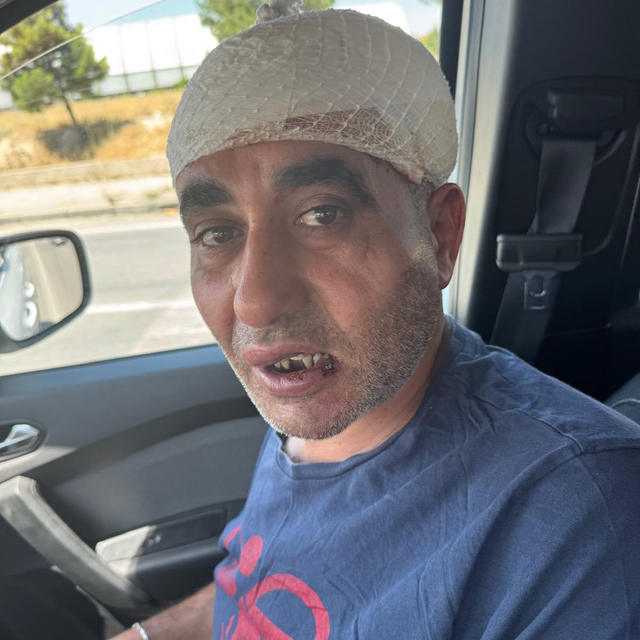 Eğlence mekanında darbedildiği iddiasıyla şikayetçi oldu